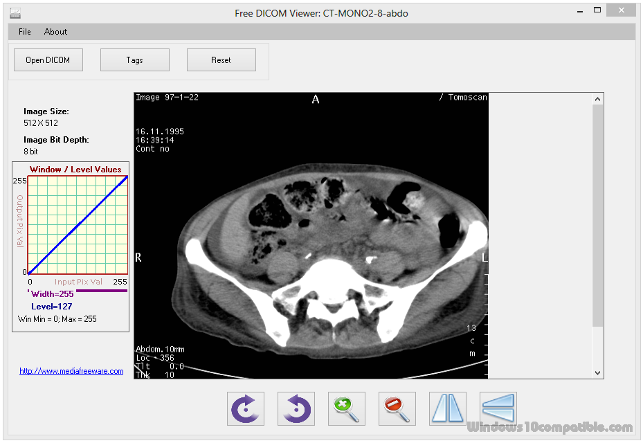 free windows 10 dicom viewer